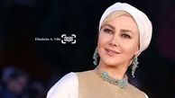  صورت بدون آرایش «آنا نعمتی»