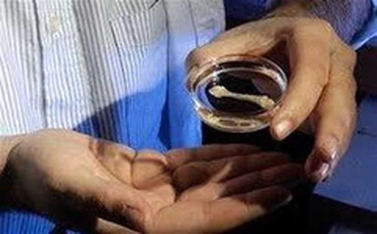 موفقیت محققان در پرورش استخوان از چربی
