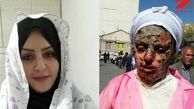 آخرین وضعیت پرونده اسیدپاشی به معصومه در تبریز 