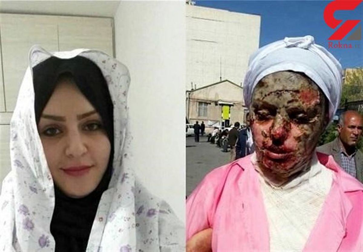 آخرین وضعیت پرونده اسیدپاشی به معصومه در تبریز 
