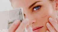 از بین بردن جای زخم و بخیه با روش های پزشکی و 22 روش گیاهی