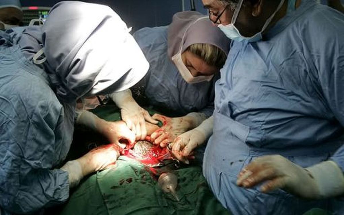 تاثير طرح تحول نظام سلامت در كاهش سزارين درکشور/ترويج زايمان بي‌درد