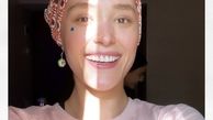 صورت آفتاب خورده بازیگر قورباغه + عکس