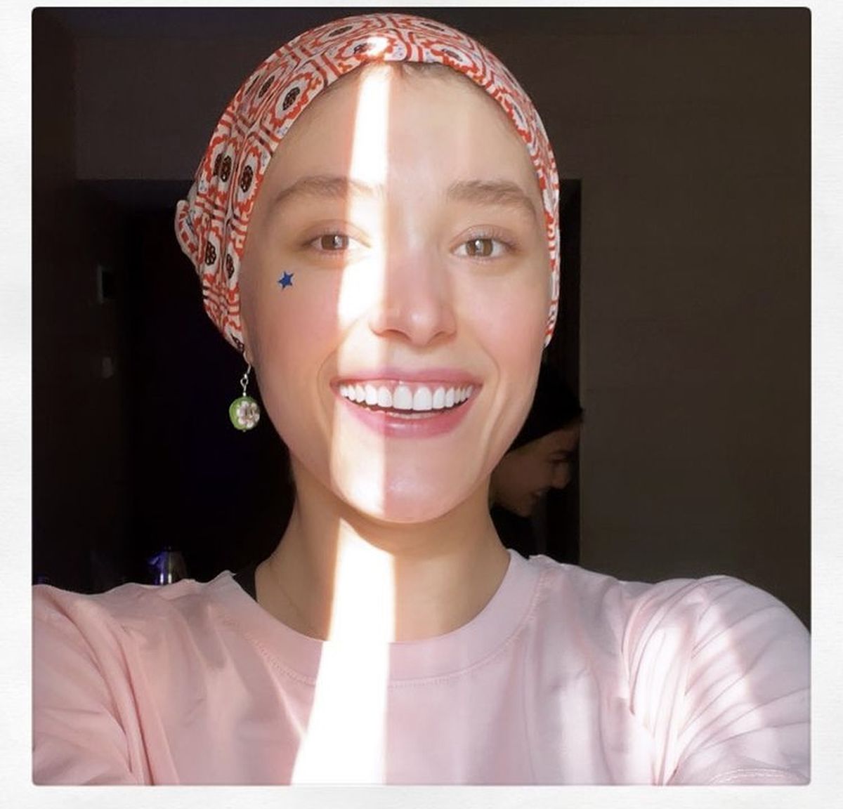 صورت آفتاب خورده بازیگر قورباغه + عکس