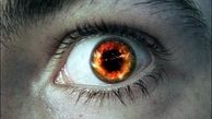 ماجرای چشم برزخی دختر عشایر+ عکس