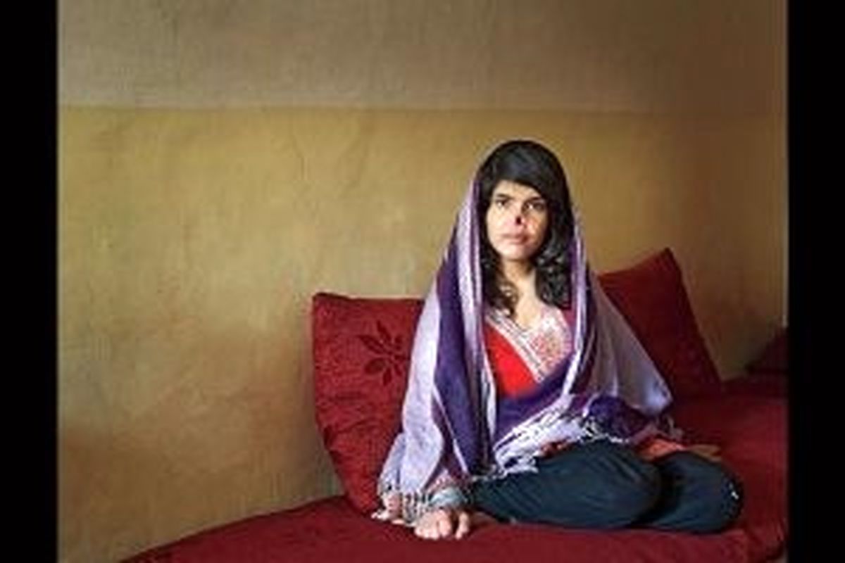 دستگیری مردی که بینی عروسش را برید