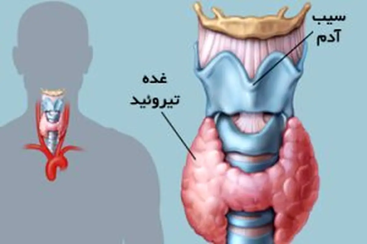 دلایل ایجاد مشکلات تیروئیدی در بدن