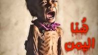  به زجر یمن پایان دهید