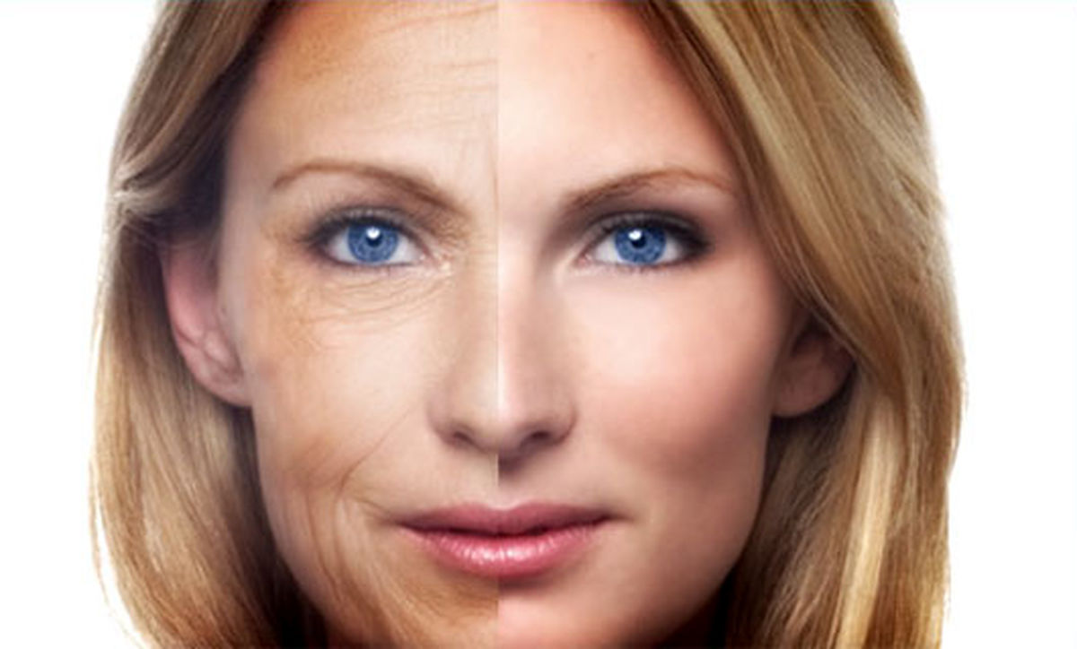 آیا طب سوزنی چگونه بر چین و چروک اثر می کند؟