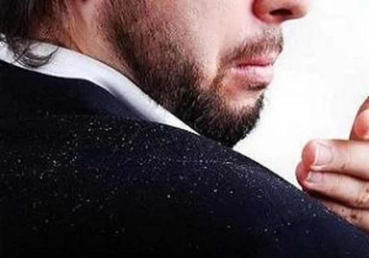 با دانه های مزاحم سفید مو چه کنیم؟ 