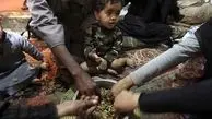هشدار مقام سازمان ملل درباره وقوع قحطی در یمن