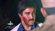 صورت زخمی و خونی پوریا پورسرخ + عکس