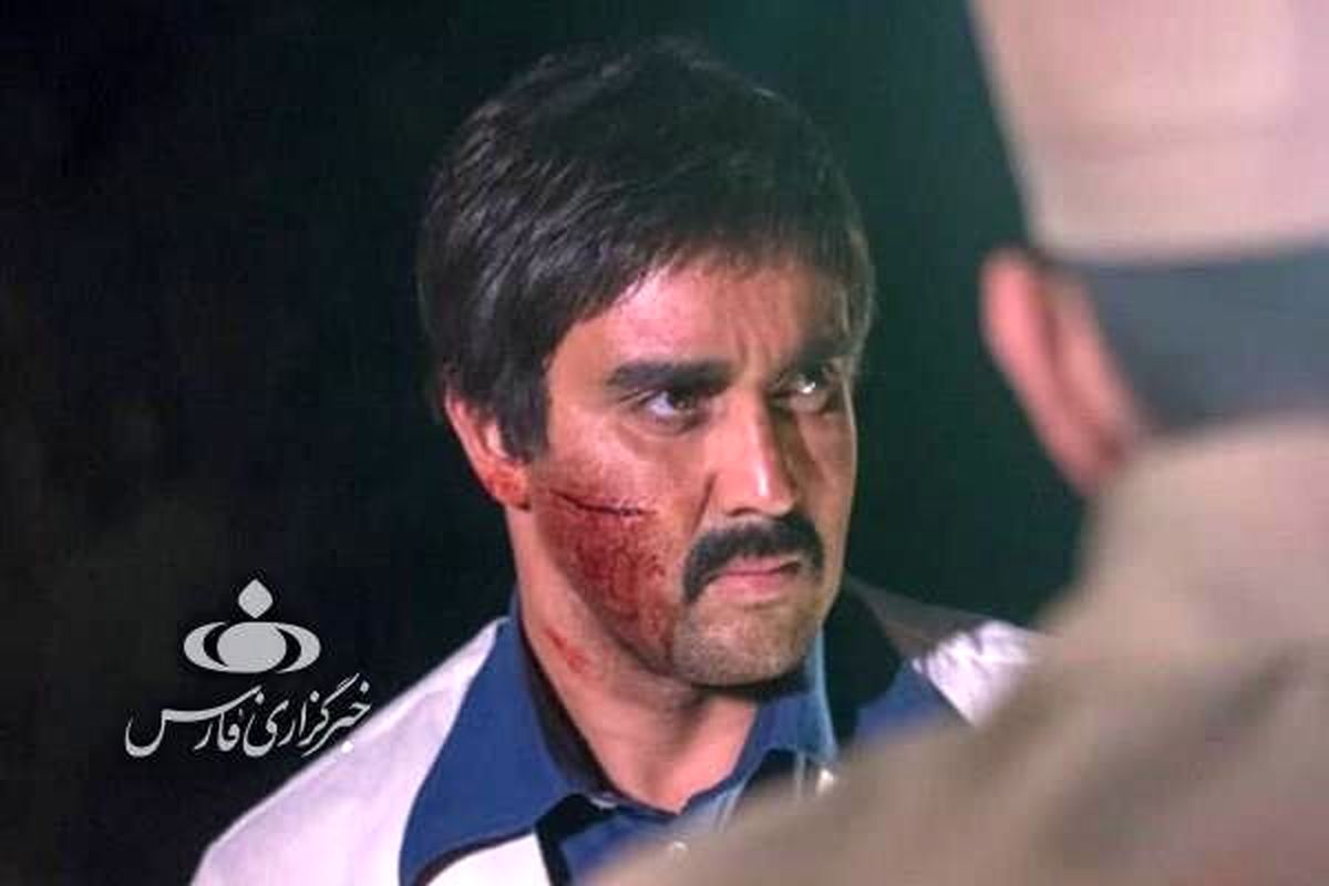 صورت زخمی و خونی پوریا پورسرخ + عکس