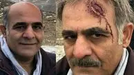 پیشونی زخم شده بازیگر فوق لیسانسه ها + عکس