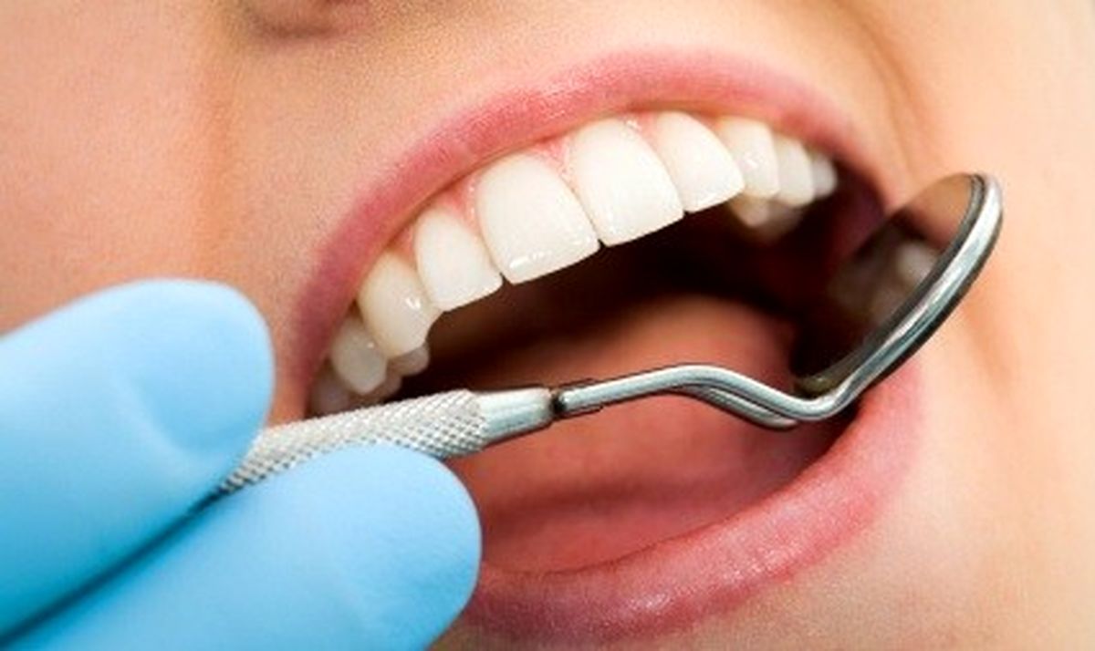 افزایش پوسیدگی دندان با استرس