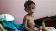 سازمان ملل: ۲۲ میلیون یمنی کمک نیاز دارند