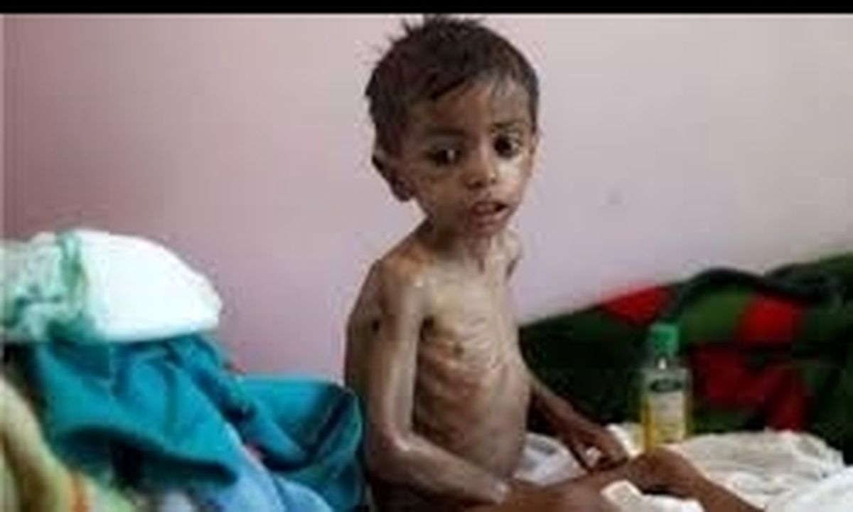 سازمان ملل: ۲۲ میلیون یمنی کمک نیاز دارند