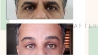10 سال جوانتر شو !