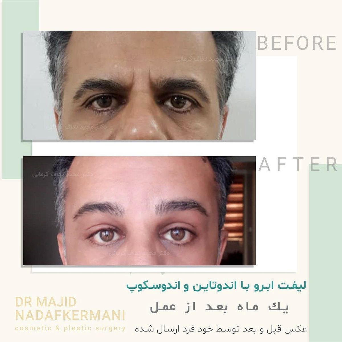 10 سال جوانتر شو !