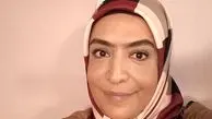 ساناز سماواتی با ابروی پیوندی + عکس