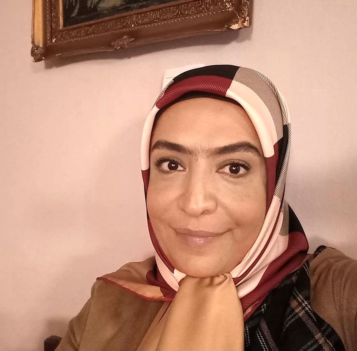 ساناز سماواتی با ابروی پیوندی + عکس
