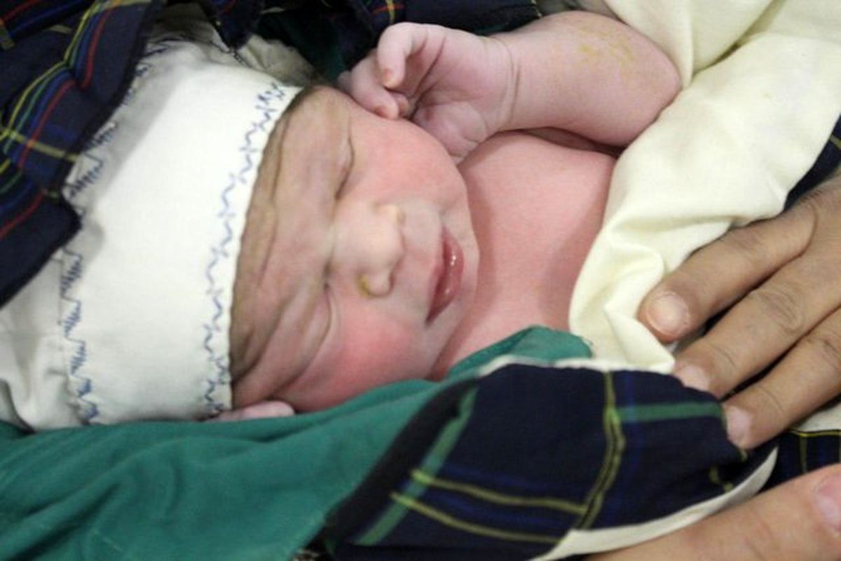 تولد نوزاد به روش پیشرفته IVF 