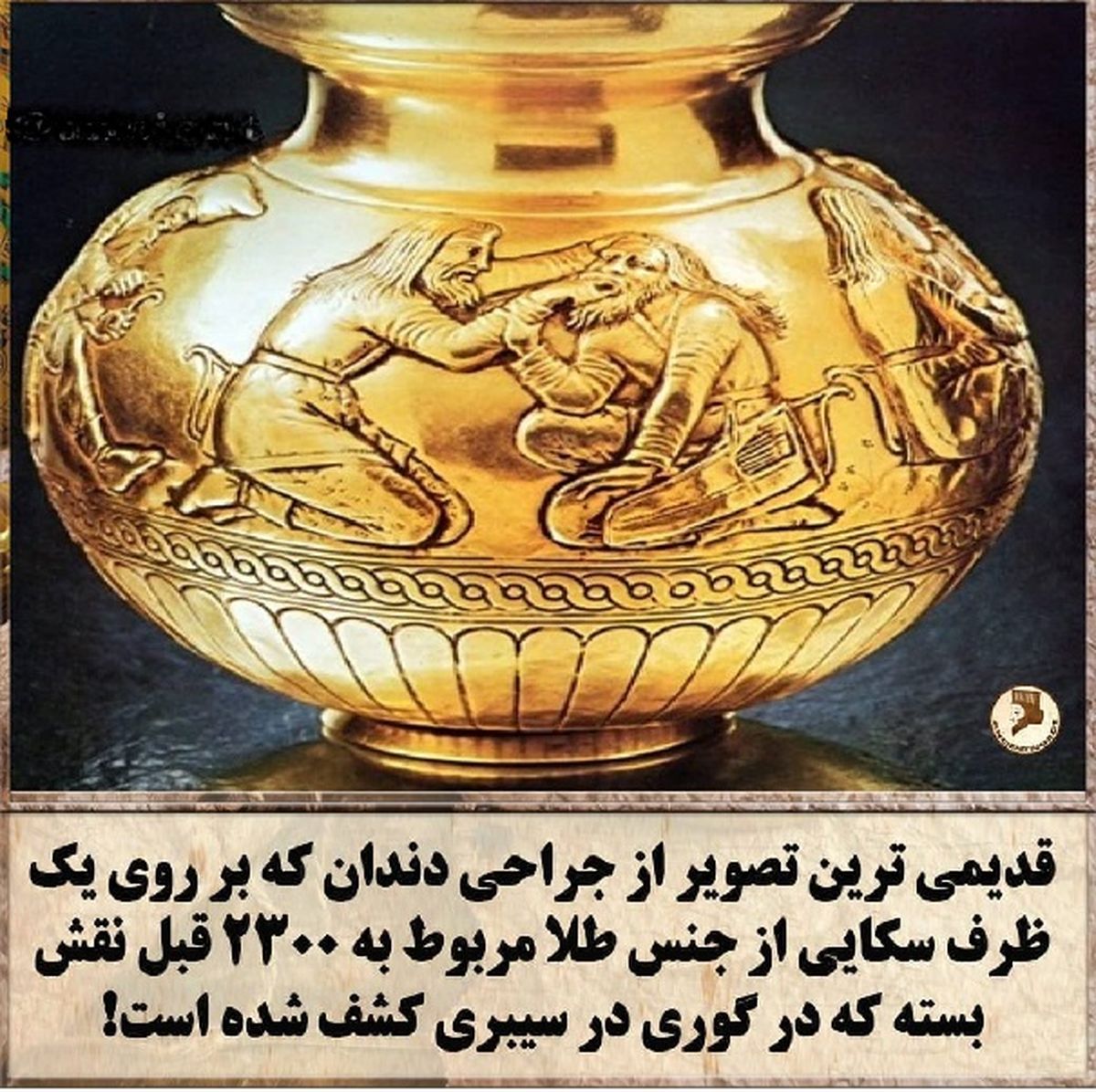 قدیمی ترین تصویر از جراحی دندان