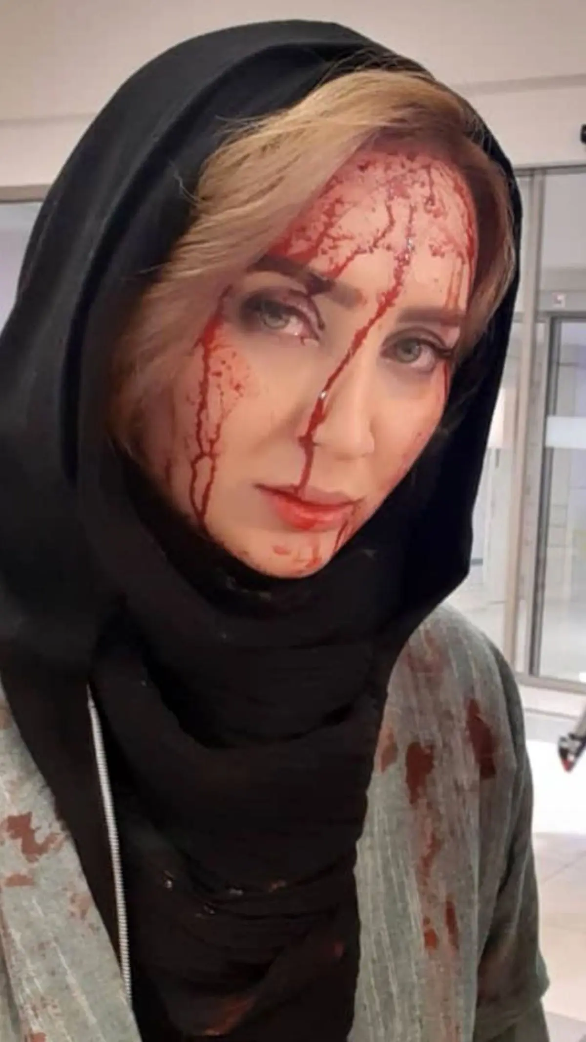 سولماز حصاری زخمی شد + عکس