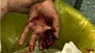 جوان 20 ساله بر اثر جراحات در گذشت