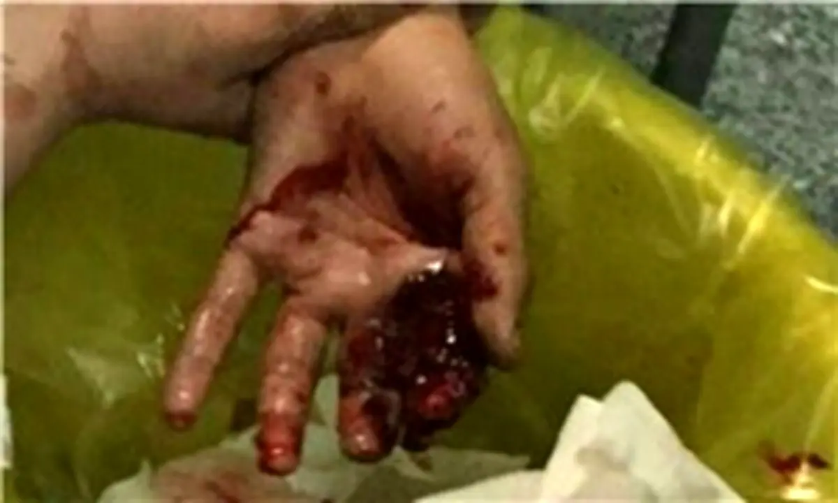 جوان 20 ساله بر اثر جراحات در گذشت