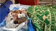 اهدا اعضای بدن دختر۱۹ ساله