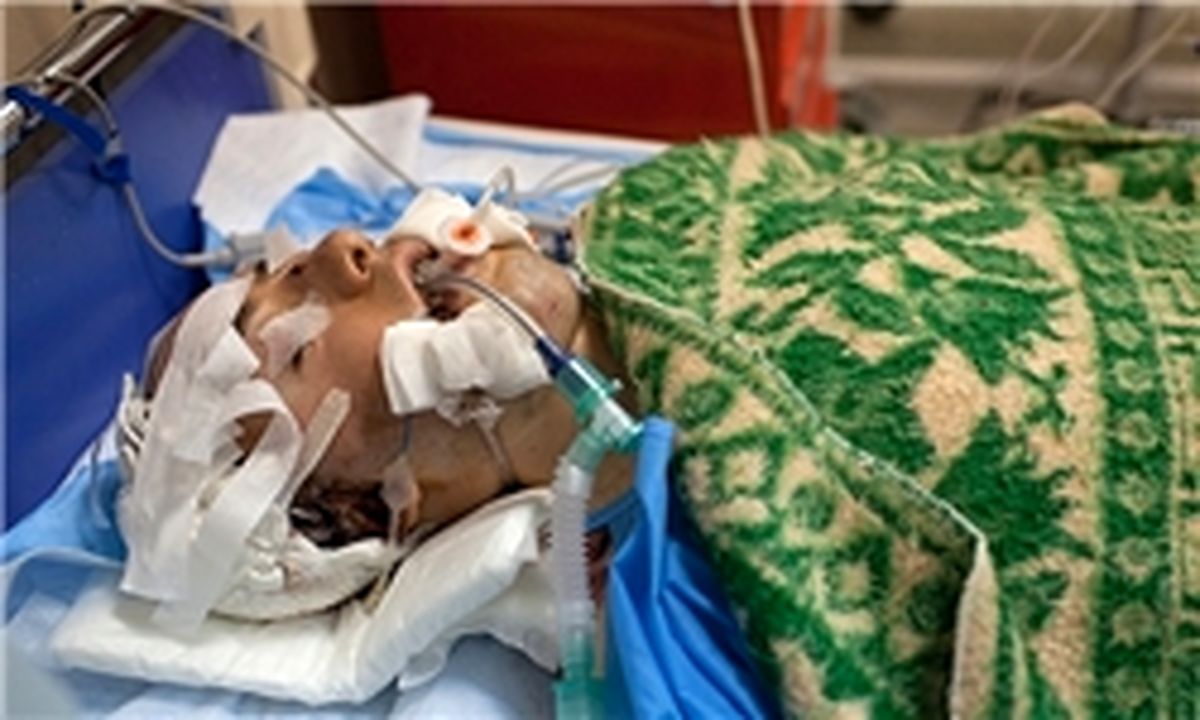 اهدا اعضای بدن دختر۱۹ ساله
