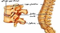 نشانه های دیسک کمر + جزئیات