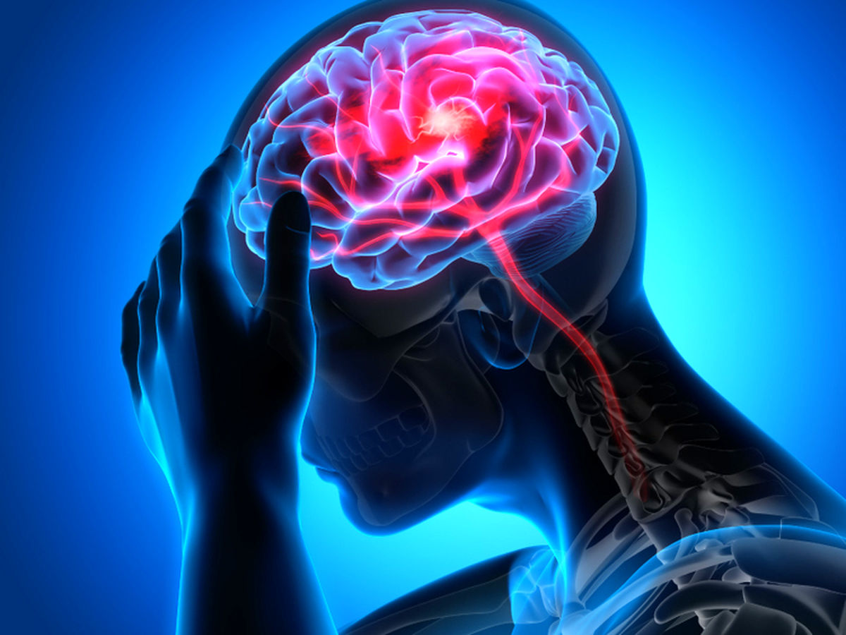 عارضه جدید کرونا؛ سکته ناگهانی