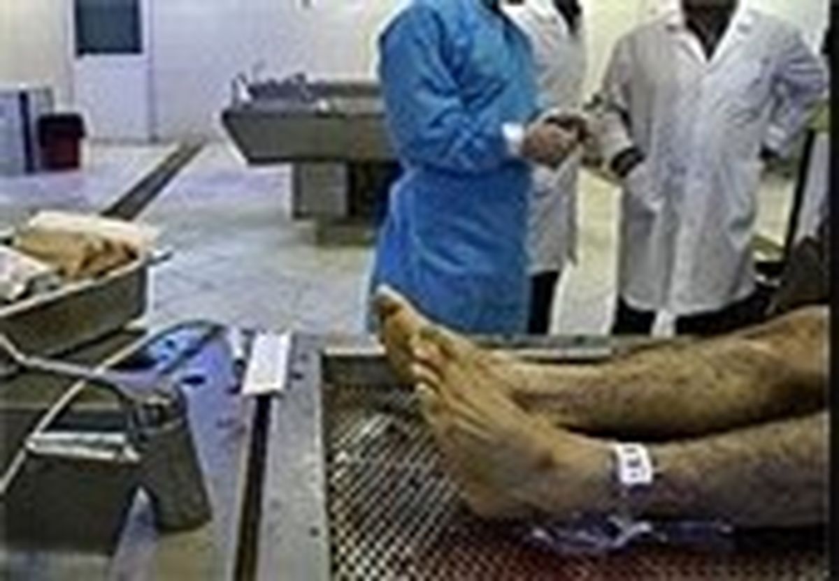 بیمارستان‌هایی که قاچاقی پیوند می‌کنند