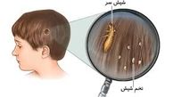 دلایل شیوع بیماری شپش در کودکان