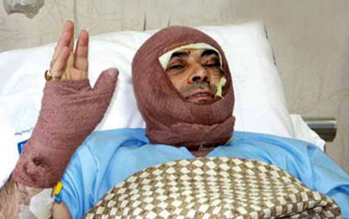 بررسي پرونده اسیدپاشی پزشک متخصص در آخرین روزهای‌ سال
