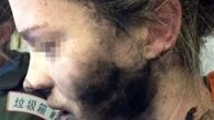 صورت مسافر زن هواپیما به دلیل انفجار هدفون سوخت+عکس