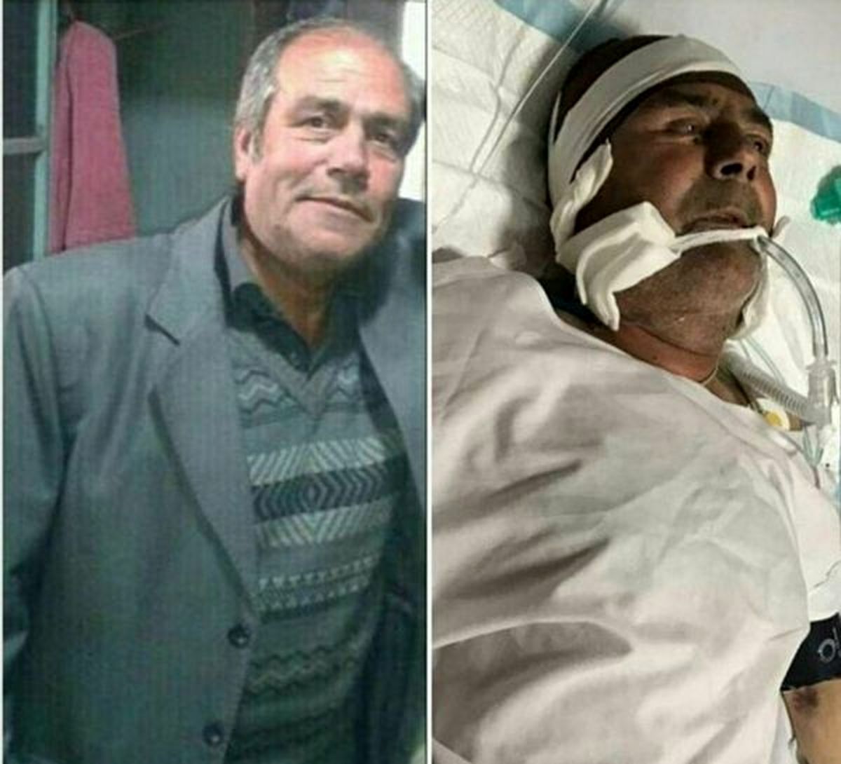 بازیگر «قلاده‌های طلا» زیر تیغ جراحی/عکس