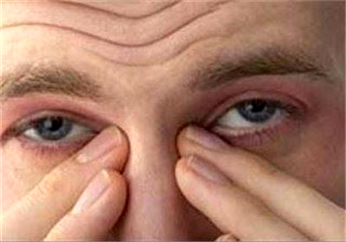 آسیب‌ چشمی پایتخت‌نشینان به دلیل آلودگی هوا
