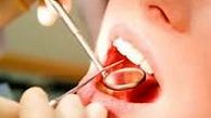 ابزار دکتر دندانپزشک بعد از دو سال در معده بیمار پیدا شد + عکس