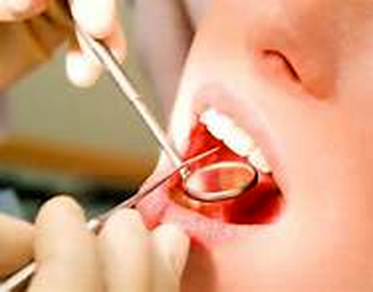 ابزار دکتر دندانپزشک بعد از دو سال در معده بیمار پیدا شد + عکس