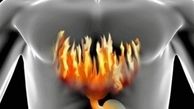 این غذاها شما را به ریفلاکس معده مبتلا می کند؟