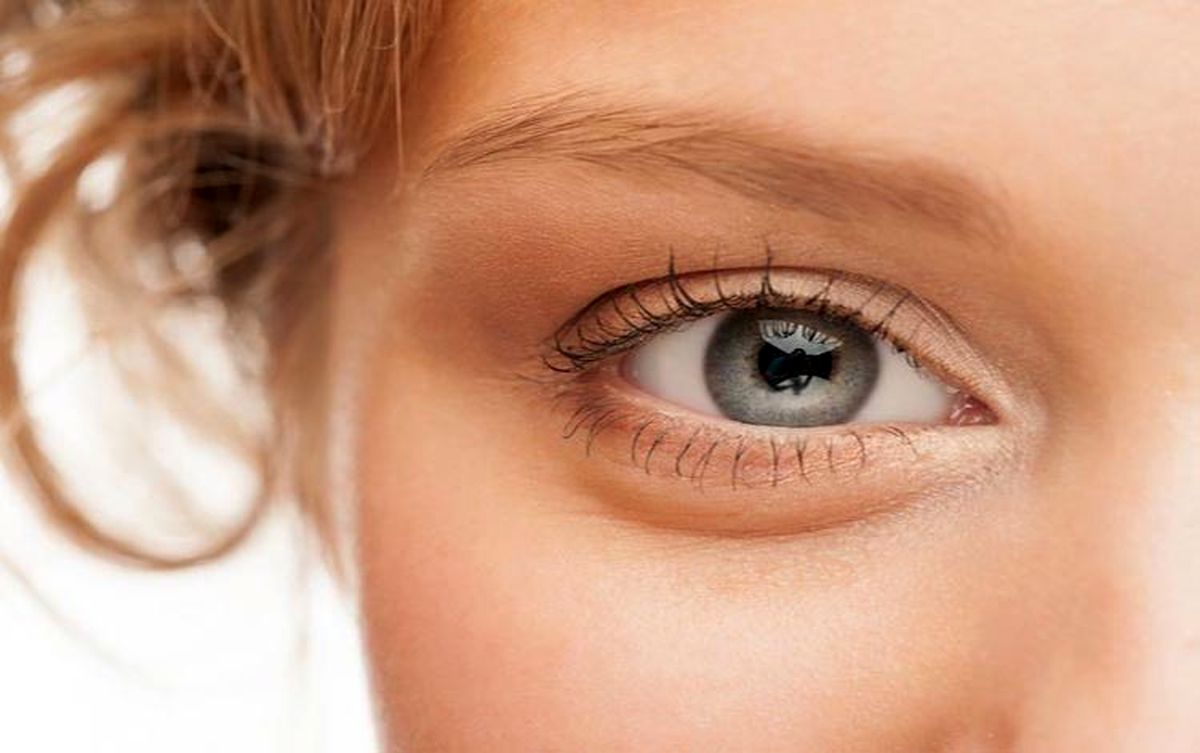 چگونه از شر پف زیر چشم خلاص شویم؟