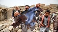 حمله دوباره سعودی به یمن/فیلم