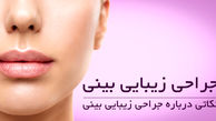 نکاتی که باید بعد از جراحی بینی رعایت کرد 