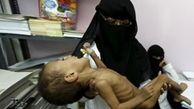  هشدار سازمان ملل درباره عدم امنیت غذایی در یمن