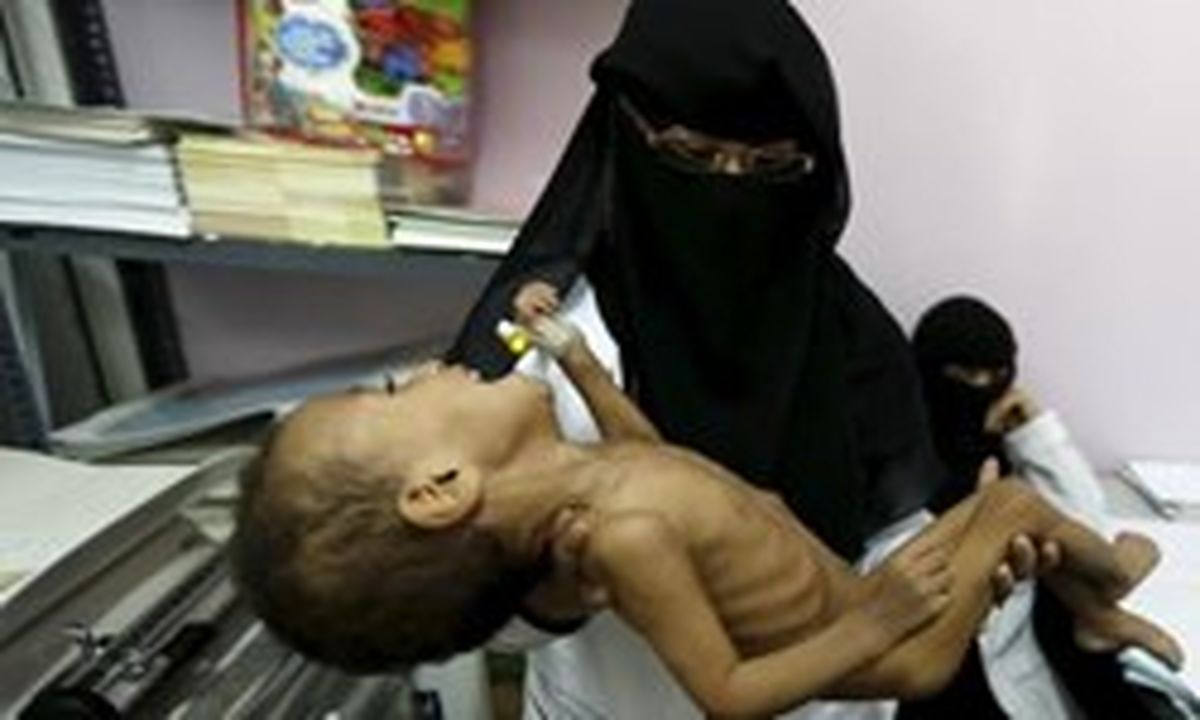 هشدار سازمان ملل درباره عدم امنیت غذایی در یمن
