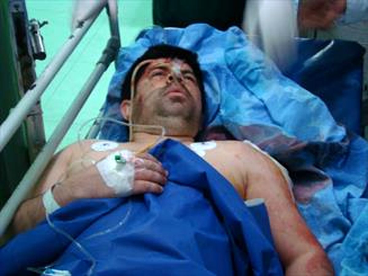 آمادگی مجلس برای اصلاح قوانین شکار و صید