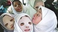 معوقات پرداخت های وزارت‌بهداشت به هزینه درمان دختران شین‌آبادی رسید